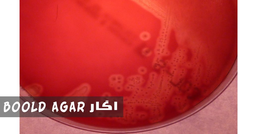 آگار خون آگار بولد بهترین آگارد