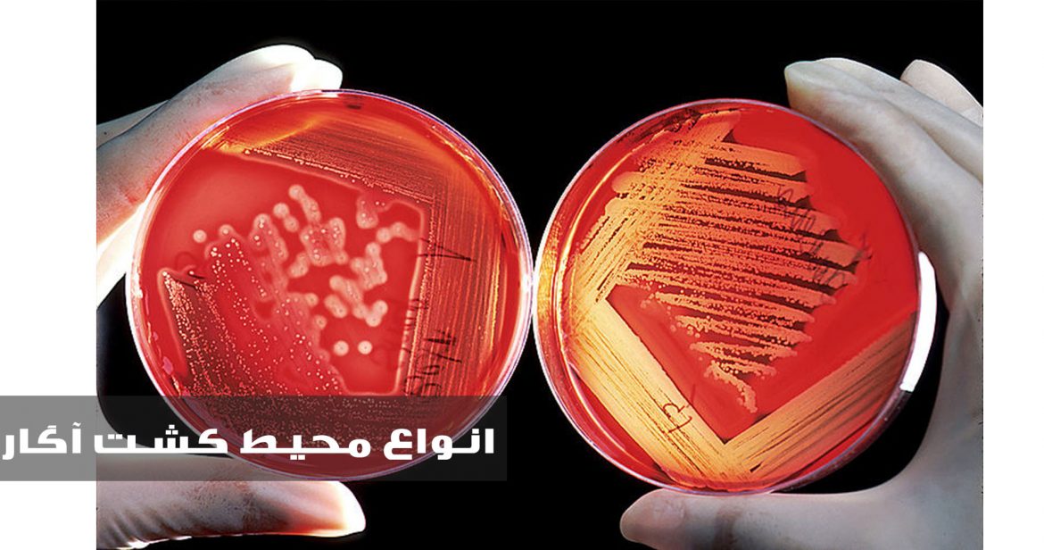 انواع محیط های آگار